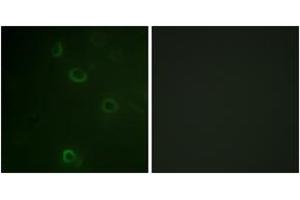 Immunofluorescence analysis of COS7 cells, using ATPase (Ab-16) Antibody.