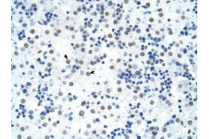 SREBF1 antibody was used for immunohistochemistry at a concentration of 16.
