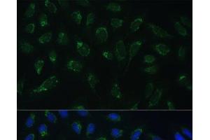 Immunofluorescence analysis of U-2 OS cells using HIGD1A Polyclonal Antibody at dilution of 1:100 (40x lens). (HIGD1A anticorps)