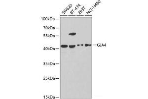Western blot analysis of extracts of various cell lines using GJA4 Polyclonal Antibody at dilution of 1:1000.