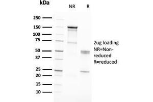 SDS-PAGE Analysis Purified RAD51 Mouse Monoclonal Antibody (RAD51/2701).