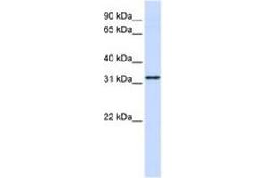 Image no. 1 for anti-Nanos Homolog 1 (NANOS1) (AA 108-157) antibody (ABIN6740717) (Nanos Homolog 1 anticorps  (AA 108-157))