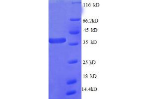 SDS-PAGE (SDS) image for Ribosomal Protein L27 (RPL27) (AA 2-85) protein (GST tag) (ABIN5712640) (RPL27 Protein (AA 2-85) (GST tag))
