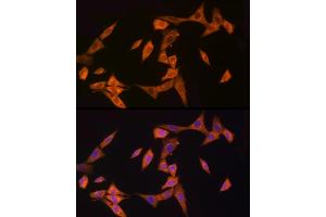 Immunofluorescence analysis of NIH/3T3 cells using NOD2 Rabbit pAb (ABIN7269065) at dilution of 1:150 (40x lens). (NOD2 anticorps  (AA 611-910))