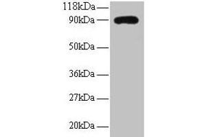 Western blot All lanes: RPL38 antibody at 2 μg/mL + EC109 whole cell lysate Secondary Goat polyclonal to rabbit IgG at 1/15000 dilution Predicted band size: 90 kDa Observed band size: 90 kDa (RPL38 anticorps  (AA 1-70))