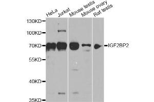 Western blot analysis of extracts of various cell lines, using IGF2BP2 antibody (ABIN6293018) at 1:1000 dilution. (IGF2BP2 anticorps)