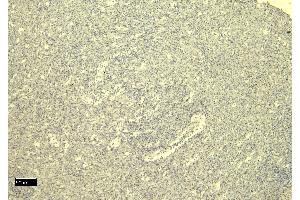 (ABIN184738) Negative Control showing staining of paraffin embedded Human Spleen, with no primary antibody.