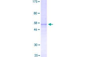 Fibroblast Growth Factor 23 (FGF23) (AA 1-251) protein (GST tag)