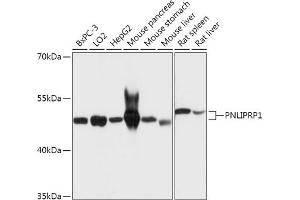 Western blot analysis of extracts of various cell lines, using PNLIPRP1 antibody (ABIN7269167) at 1:1000 dilution. (PNLIPRP1 anticorps  (AA 298-467))