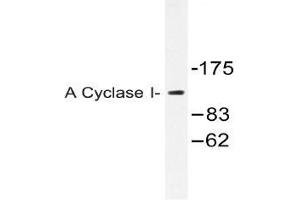 Western blot (WB) analysis of A Cyclase I antibody in extracts from COLO205 cells.