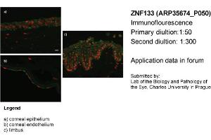 Image no. 2 for anti-Zinc Finger Protein 133 (ZNF133) (N-Term) antibody (ABIN405011)