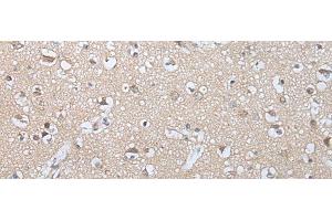 Immunohistochemistry of paraffin-embedded Human brain tissue using GZMM Polyclonal Antibody at dilution of 1:25(x200)