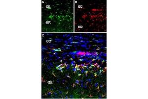 Expression of mGluR2 in rat brain - Immunohistochemical staining of perfusion-fixed brain frozen sections using Anti-mGluR2 (extracellular) Antibody (ABIN7043247, ABIN7044340 and ABIN7044341).
