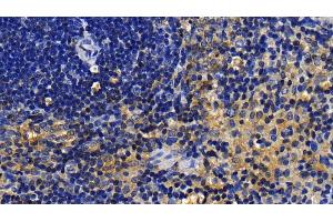 Detection of IRAK2 in Rat Spleen Tissue using Polyclonal Antibody to Interleukin 1 Receptor Associated Kinase 2 (IRAK2)
