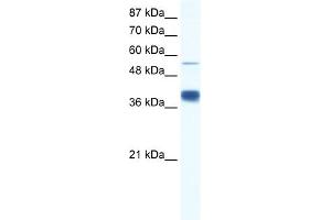 WB Suggested Anti-DKFZP781I1119 Antibody Titration:  0. (DKFZP781I1119 (N-Term) anticorps)