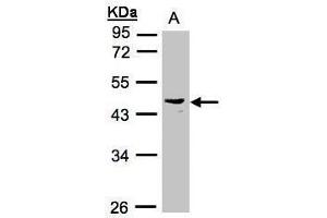 WB Image Sample(30 ug whole cell lysate) A:Raji , 10% SDS PAGE antibody diluted at 1:1000 (PSG6 anticorps)