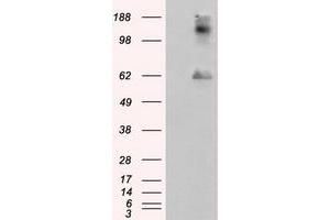 Image no. 7 for anti-Lipase, Endothelial (LIPG) antibody (ABIN1499165) (LIPG anticorps)
