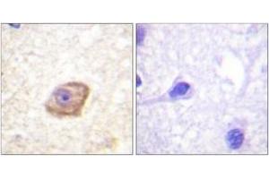 Immunohistochemistry analysis of paraffin-embedded human brain, using NMDAR2B (Phospho-Tyr1474) Antibody. (GRIN2B anticorps  (pTyr1474))