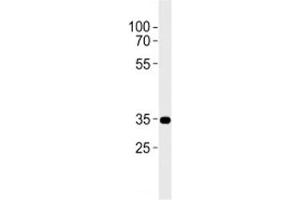 CB2 antibody western blot analysis in A431 lysate. (CNR2 anticorps  (AA 329-356))