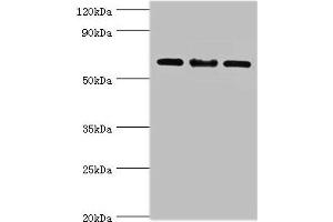 Western blot All lanes: IL22RA1 antibody at 10 μg/mL Lane 1: Mouse spleen tissue Lane 2: HepG2 whole cell lysate Lane 3: 293T whole cell lysate Secondary Goat polyclonal to rabbit IgG at 1/10000 dilution Predicted band size: 63 kDa Observed band size: 63 kDa (IL22 Receptor alpha 1 anticorps  (AA 16-230))
