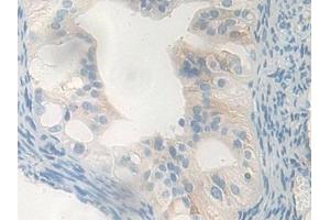 Detection of CPB1 in Mouse Oviduct Tissue using Polyclonal Antibody to Carboxypeptidase B1, Tissue (CPB1) (CPB1 anticorps  (AA 109-415))