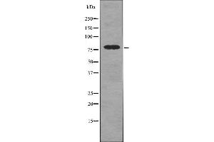 Western blot analysis DRP1 (pS616) using UV treated 293 whole cell lysates. (Dynamin 1-Like anticorps  (pSer616))