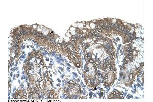 Immunohistochemistry (IHC) image for anti-Retinoic Acid Receptor Responder (Tazarotene Induced) 3 (RARRES3) (Middle Region) antibody (ABIN2782646) (RARRES3 anticorps  (Middle Region))