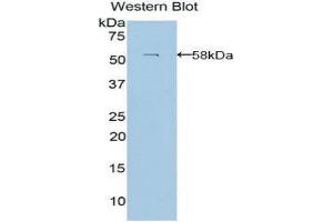 Western Blotting (WB) image for anti-Laminin, beta 3 (LAMB3) (AA 352-587) antibody (ABIN1859605) (Laminin beta 3 anticorps  (AA 352-587))