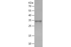 Western Blotting (WB) image for Alkaline Phosphatase, Liver/bone/kidney (ALPL) (AA 19-113) protein (His-IF2DI Tag) (ABIN7121791) (ALPL Protein (AA 19-113) (His-IF2DI Tag))