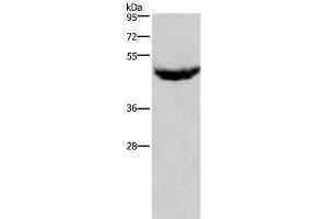 Western Blot analysis of Human serum solution using IL8RB Polyclonal Antibody at dilution of 1:125