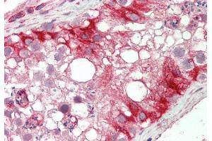 Rabbit Anti-KLHL25 antibody  Formalin Fixed Paraffin Embedded Tissue: Human Testis Primary antibody Concentration: 1:100 Secondary Antibody: Donkey anti-Rabbit-Cy3 Secondary Antibody Concentration: 1:200 Magnification: 20x Exposure Time: 0. (KLHL25 anticorps  (N-Term))