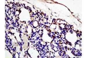 Formalin-fixed and paraffin embedded rat lung labeled with Rabbit Anti-Complement fragment 3c Polyclonal Antibody (ABIN873279) at 1:200 followed by conjugation to the secondary antibody and DAB staining (Complement C3c anticorps  (AA 1051-1200))