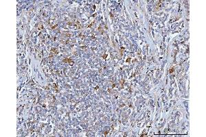 IHC analysis of BCAT1 using anti-BCAT1 antibody (ABIN7602594). (BCAT1 anticorps  (AA 88-386))