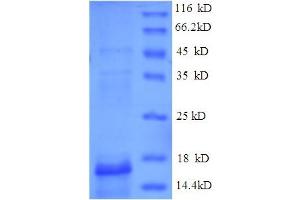 SDS-PAGE (SDS) image for Parvalbumin beta (PRVB) (AA 1-113), (full length) protein (His tag) (ABIN5711123)