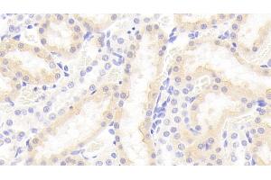Detection of vWA1 in Rat Kidney Tissue using Polyclonal Antibody to Von Willebrand Factor A Domain Containing Protein 1 (vWA1)