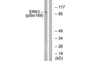 Western blot analysis of extracts from mouse brain, using ERK3 (Phospho-Ser189) Antibody. (MAPK6 anticorps  (pSer189))