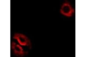 Immunofluorescent analysis of RPL14 staining in Hela cells. (RPL14 anticorps)