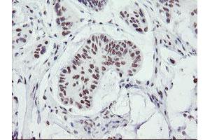 anti-SUMO1/sentrin/SMT3 Specific Peptidase 2 (SENP2) (AA 139-523) antibody