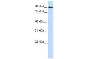 Image no. 1 for anti-Proprotein Convertase Subtilisin/kexin Type 5 (PCSK5) (AA 792-841) antibody (ABIN6743186) (PCSK5 anticorps  (AA 792-841))