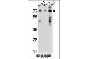 Western blot analysis in MCF-7,ZR-75-1,HepG2 cell line lysates (35ug/lane). (HSD17B4 anticorps  (AA 341-370))