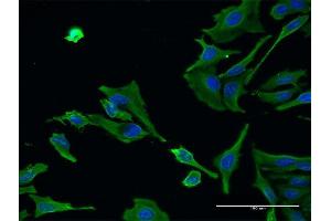 Immunofluorescence of monoclonal antibody to ALS2 on HeLa cell.
