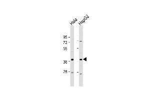 All lanes : Anti-C1GALT1C1 Antibody (N-Term) at 1:2000 dilution Lane 1: Hela whole cell lysate Lane 2: HepG2 whole cell lysate Lysates/proteins at 20 μg per lane.