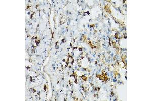 Immunohistochemistry of paraffin-embedded rat lung using TLR1 Rabbit pAb (ABIN3023654, ABIN3023655, ABIN3023656 and ABIN6214092) at dilution of 1:100 (40x lens).