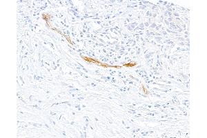 Immunohistochemistry (IHC) image for anti-Selectin E (SELE) (AA 22-555) antibody (ABIN7795699) (Recombinant Selectin E/CD62e anticorps  (AA 22-555))