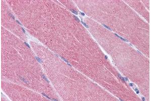 Human Skeletal Muscle: Formalin-Fixed, Paraffin-Embedded (FFPE) (CREB3L1 anticorps  (AA 497-509))