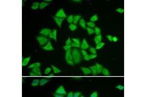 Immunofluorescence analysis of A549 cells using GSTM2 Polyclonal Antibody (GSTM2 anticorps)
