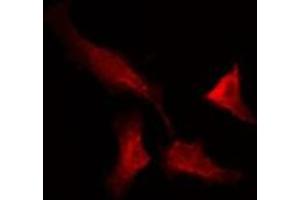 ABIN6275722 staining NIH-3T3 by IF/ICC. (ANKRD20A1 anticorps)