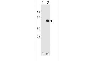 Western blot analysis of HLA-E (arrow) using rabbit polyclonal HLA-E Antibody (Center) (ABIN652456 and ABIN2842310). (HLA-E anticorps  (AA 108-135))