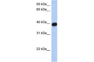 WB Suggested Anti-CXCR6 Antibody Titration:  0. (CXCR6 anticorps  (N-Term))