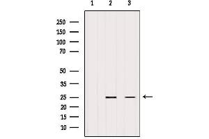 Western blot analysis of extracts from various samples, using eIF4E Antibody.